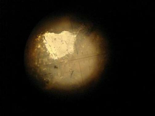 Исследование камня и результаты исследования под микроскопом